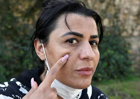 Antalya’da güzellik merkezine giden Aslı İlhan hayatının şokunu yaşadı! Yüzü yandı tehdit edildi