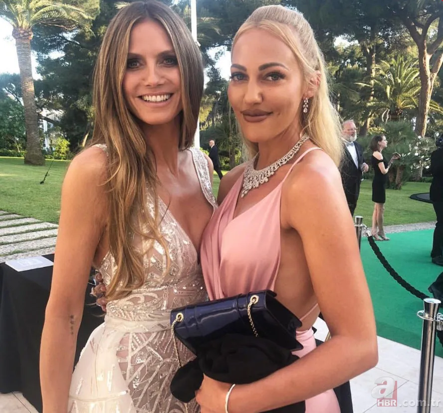 Binlerce lirası boşa gitti! Estetiği fazla kaçıran Meryem Uzerli tanınmaz hale geldi! 12