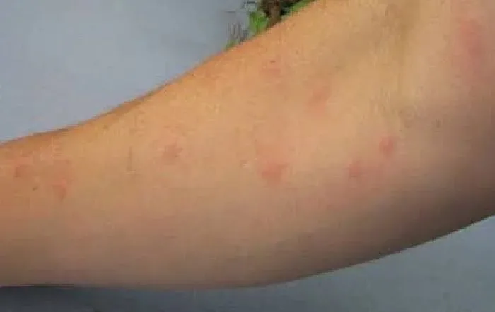 Sapanca’da Asya Kaplan’ı cinsi sivrisinekler tatilcileri canından bezdirdi
