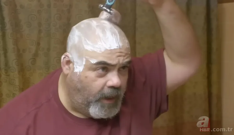 Sokağa şapka ile çıkıyordu! Başındaki şişlikten bakın ne çıktı 👩⚕️ Görenleri şaşkına çeviren olay 18