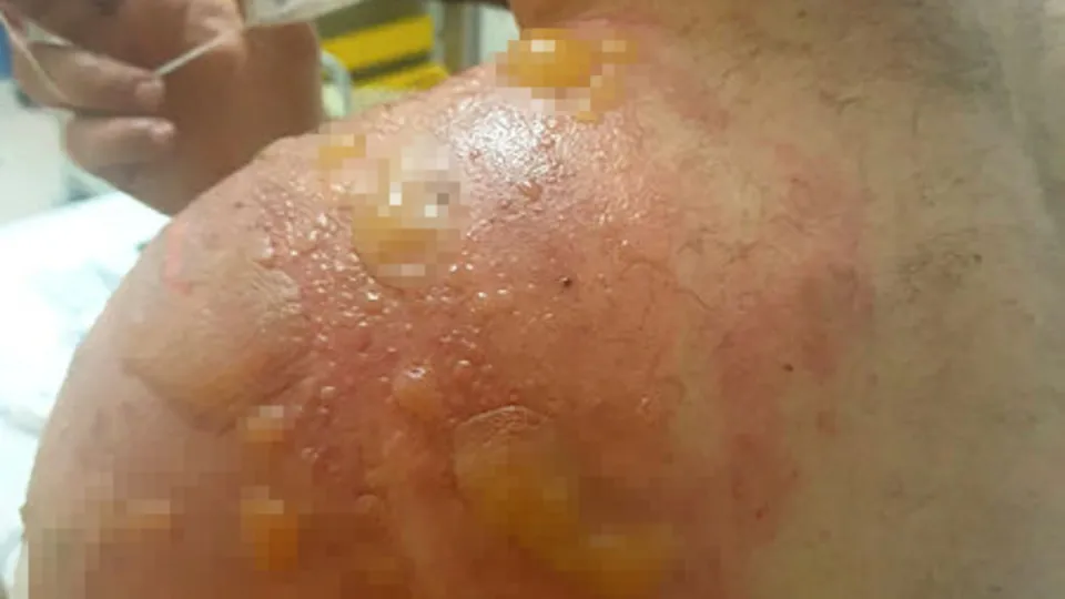 Son dakika | Kanınız donacak! İnsan insana bunu yapar mı? 'Kardeşimizden boşan' diye 40 dakika dövüp kaynar su döktüler