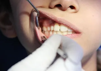 Yaz aylarında çocukların diş sağlığı için önemli uyarılar