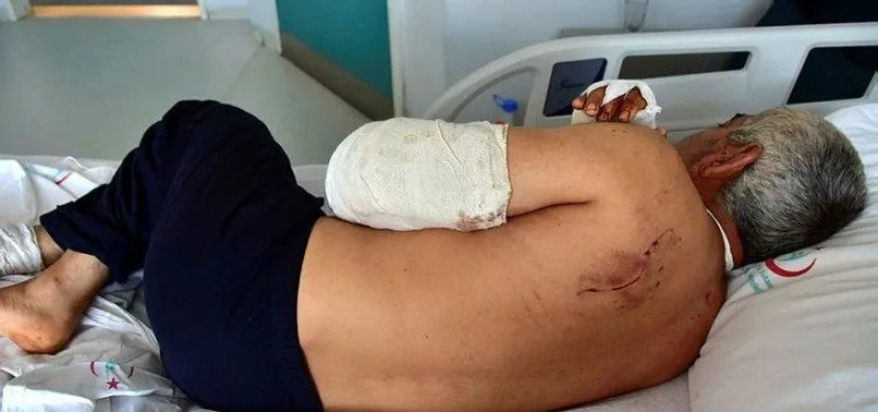 Muğla'da pitbull dehşeti! Kolunu parçaladılar