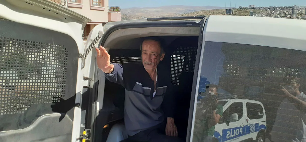 Ankara’da “Hannibal” koca karısının parmağını ısırarak koparttı