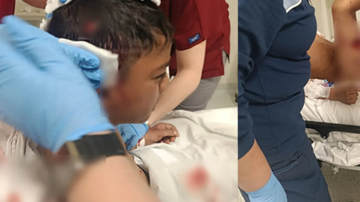 Başıboş köpek terörü! Küçük çocuğa saldırdılar hastanelik oldu: Çocuğu paramparça ettiler