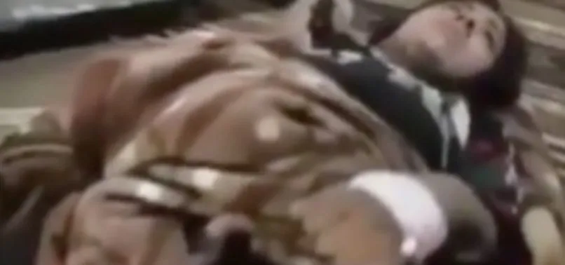 Mehmetçik, yaralı teröriste yardım elini uzattı