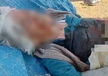 Niğde'de sokak köpeği dehşeti! Yaşlı kadın az kalsın parçalanıyordu