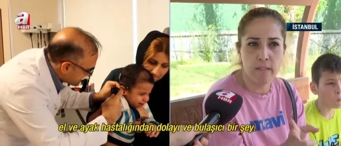 cocuklarin-kabusu-el-ve-ayak-hastaligi-en-net-belirtisi-ates-ve-vucuttaki-dokuntuler-1728762349243.jpg Çocukların kabusu 'el ve ayak hastalığı'! En net belirtisi ateş ve vücuttaki döküntüler - 3