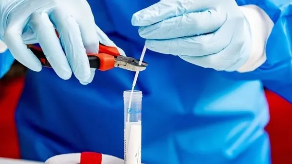 Koronavirüs aşısı için klinik denemelerine başladı - 2