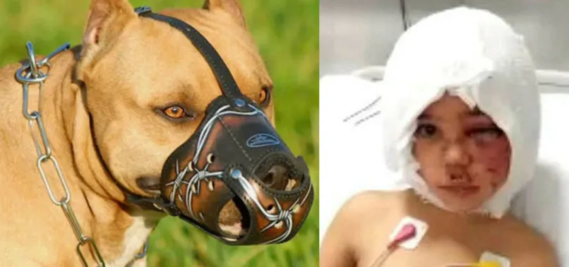 İngilizlerin canavarlaştırdığı köpek: Pitbull! Asiye'nin uğradığı saldırıyla ilgili bilinmeyen detaylar! Pitbullar nasıl bu hale geldi?