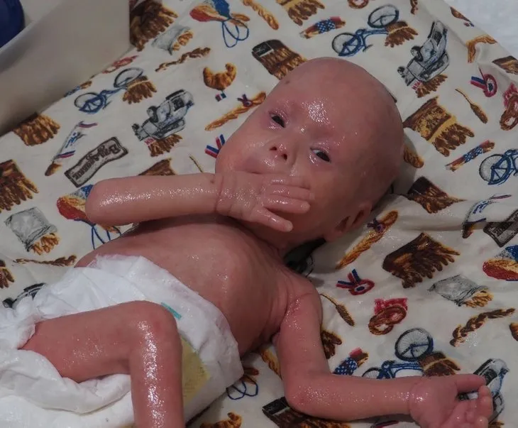 Yılan bebek Gökdeniz Tuncer 1 yaşına girdi! Annesi sadece bir kez öpebildi