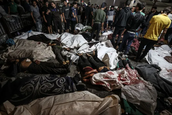 İsrail’in Gazze’de hastane saldırısı dünya medyasında