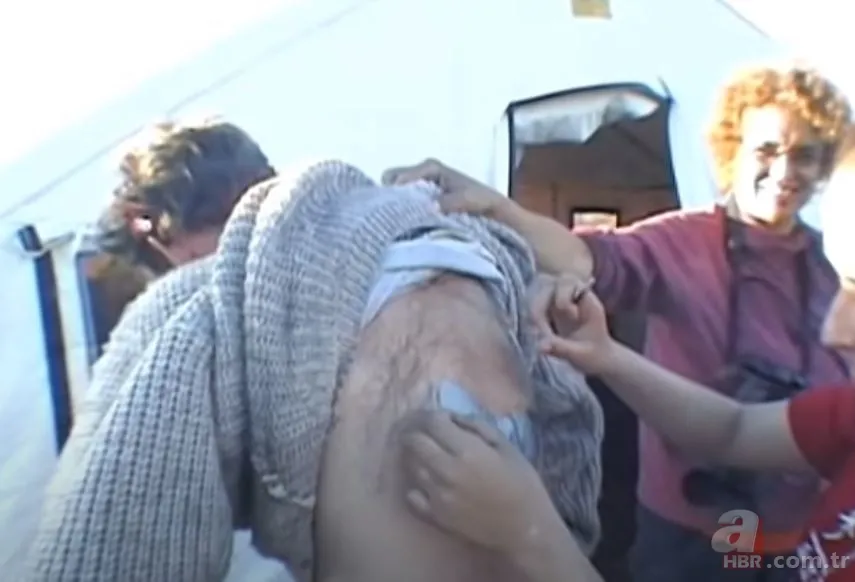 Sırtındaki yarayı sivilce zannetti ama gerçek dehşete düşürdü! Bakın içinden ne çıktı 7