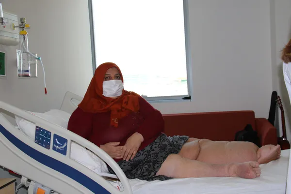 1615126209493.jpg 5 yıldır sokağa bile çıkamıyordu! Fil hastası kadın Ankara Şehir Hastanesi'nde şifa buldu - 1