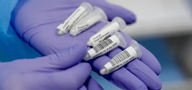 Sağlık Bakanlığı’ndan flaş koronavirüs hamlesi! Koronavirüs test kitleri...