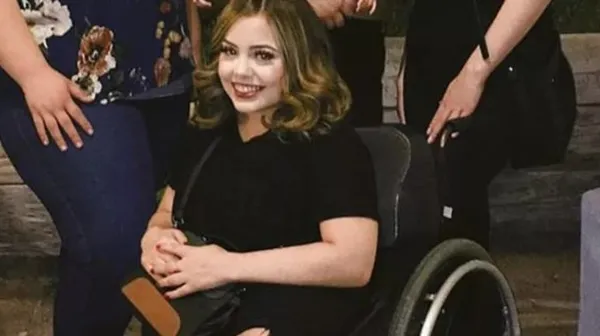 Kaybettiği yapışık ikizinin hayalini gerçekleştirdi! Hikayeleri Yürek bukrtu