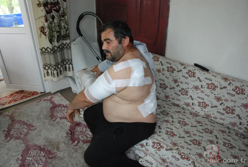 Bartın'da ayı saldırısı! 65 dikiş atıldı: Öldüğümü sanıp bıraktı 3