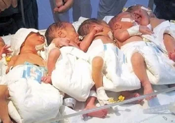 İranlı kadın altız bebek dünyaya getirdi