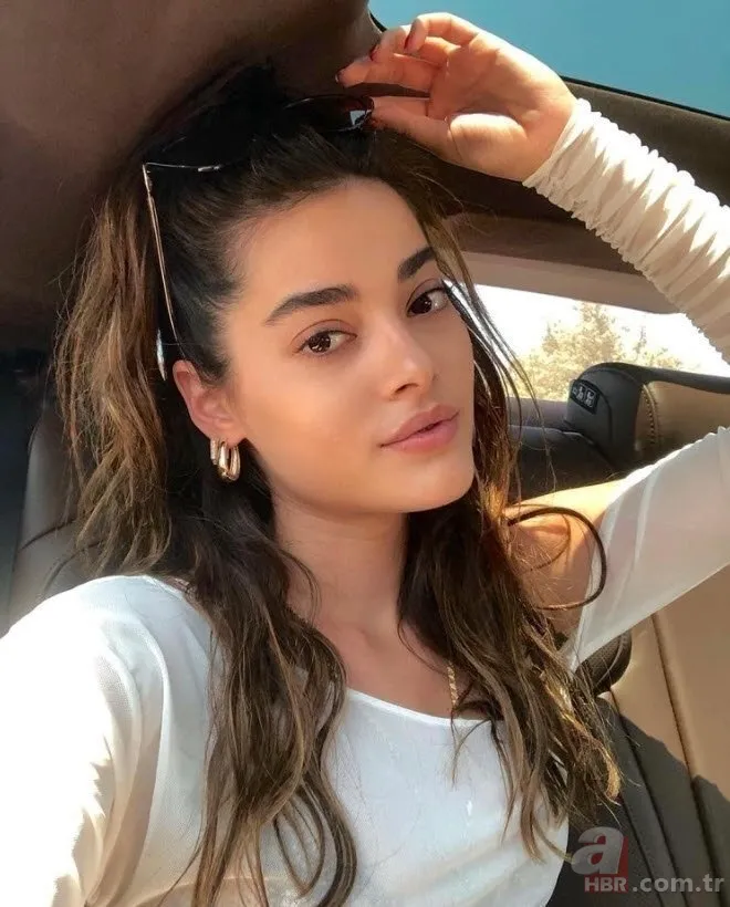 Bir Zamanlar Çukurova’nın Gülten’i Selin Genç de estetik harikası çıktı! Eski hali şoke etti 6