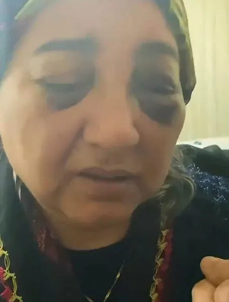 Kocaeli'de eşini dövüp 2 boyunca aç ve susuz bırakan cani koca tutuklandı - 1