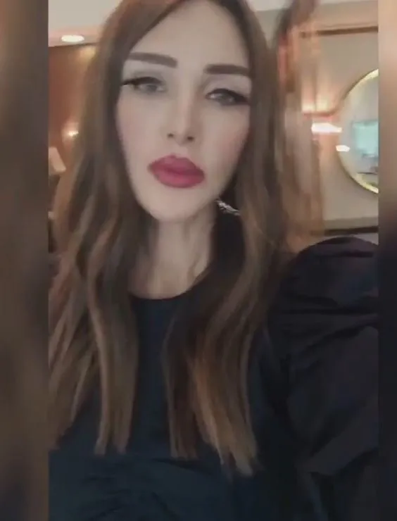 Seren Serengil Eski Ve Son Hali / Nerdeeeen Nereye Son Donemlerin En