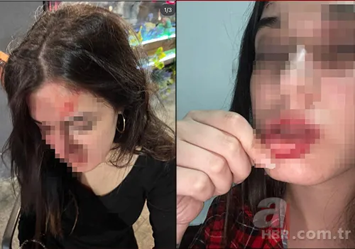 “Konuşacağız” deyip tuzak kurdu: Genç kadın dehşeti yaşadı 1