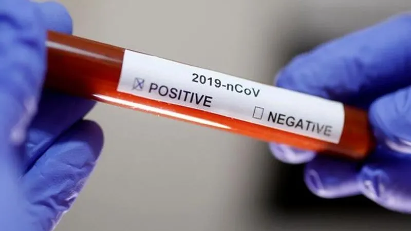 Sarimsak Koronavirusu Engeller Mi Iste Dikkat Edilmesi Gereken 5 Corona Virus Yalani