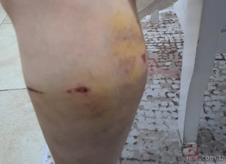 Ekrem İmamoğlu'nun danışmanı Murat Ongun'dan ısıran köpeğine koruma şikayetçi çalışana tehdit! Hem sahip çıkmadı hem işten kovdurdu 6