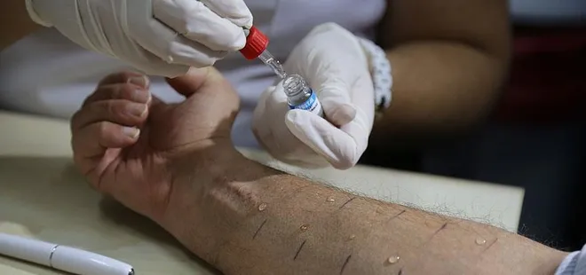 Çocuklarda besin alerjilerine dikkat!