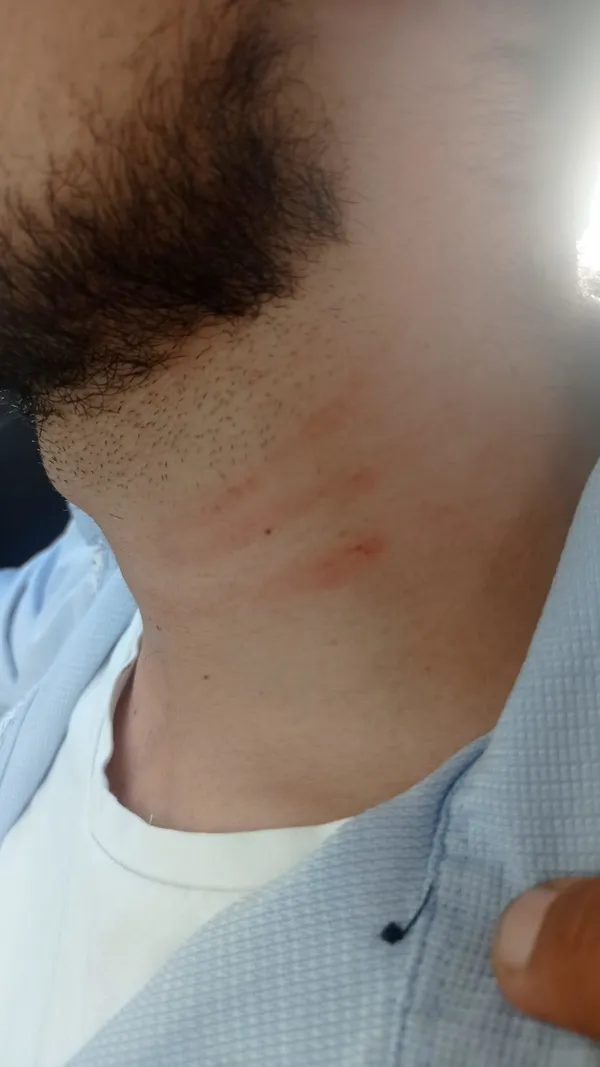 1629375937089.jpeg A Haber'e Gaziantep'te çirkin saldırı! 'Saldırgan CHP'li çıktı' - 2