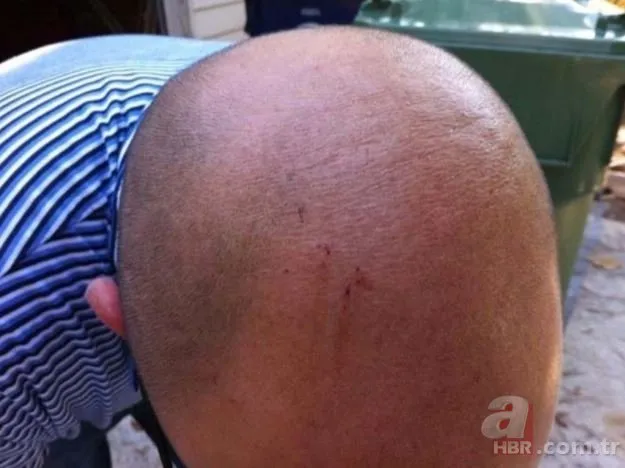 yilan adasi ni andiriyor burasi brezilya degil turkiye de bir il