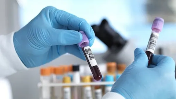 Hangi kan grubu daha sağlıklı? Hava kirliliğine karşı en dirençli kan grubu hangisi? İngiltere’deki flaş araştırma sonuçlandı