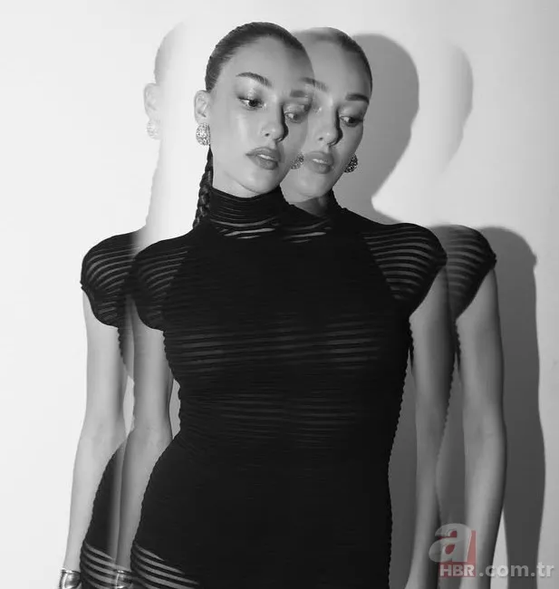 Oyuncu Dilan Çiçek Deniz'e köpek saldırdı! Sağlık durumu... 2