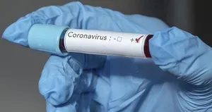 Tek amaçları aşı geliştirip koronavirüsü yenmek!