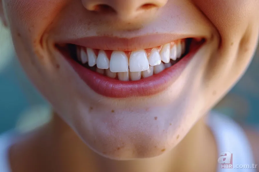 Gülüşünüzü sigortalayın! Diş hekimlerinin dişler için önerdiği 7 yiyecek! 1