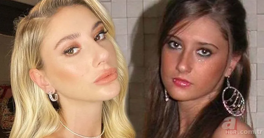 Bir Zamanlar Çukurova’nın Gülten’i Selin Genç de estetik harikası çıktı! Eski hali şoke etti 20