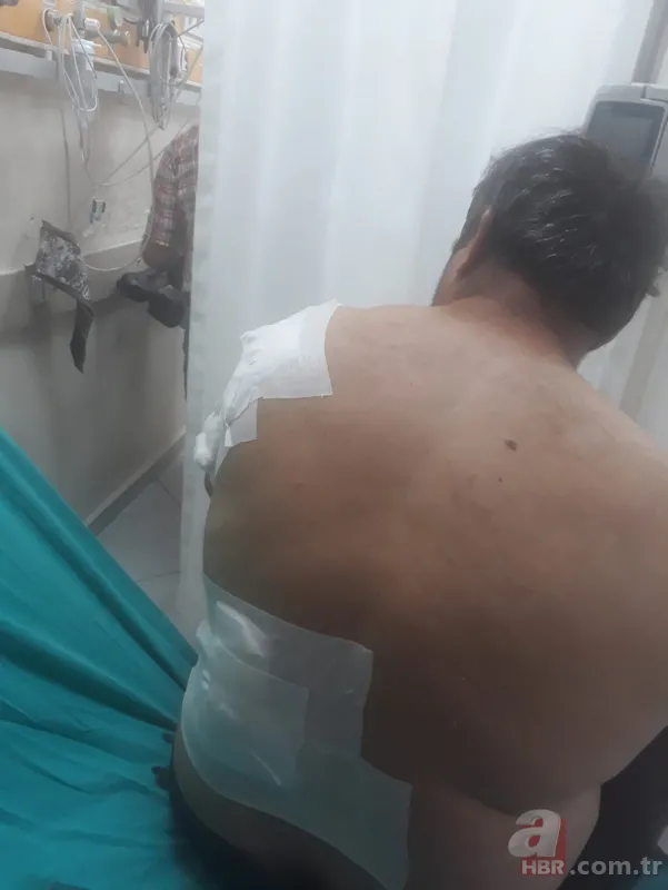 Bartın'da ayı saldırısı! 65 dikiş atıldı: Öldüğümü sanıp bıraktı 15