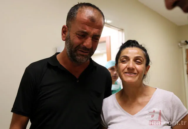 Yapışık ikizler dünyaya geldi 2