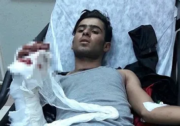 Karakola atmaya çalıştığı EYP elinde patladı