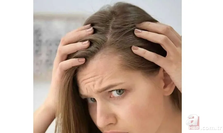 Kaşınan ve kepeklenen saçınız varsa dikkat! Bu yöntemle hem rahatlayacak hem de saçınızı uzatacaksınız 10
