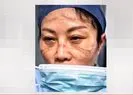 Çinli doktorların yüzündeki koronavirüs izi sosyal medyada gündem oldu |Video