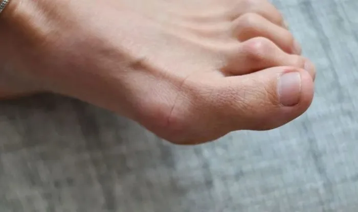 Terlik giyerken 2 kere düşüneceksiniz! Meğer o hastalıklara sebep oluyormuş…