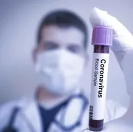 Corona virüs koronavirüs testi hangi hastanelerde ücretsiz? Sağlık Bakanlığı liste yayınladı