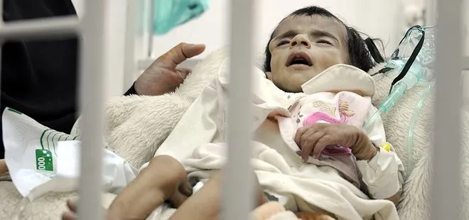 Yemen’de yarım milyon çocuk ölüm tehlikesiyle karşı karşıya