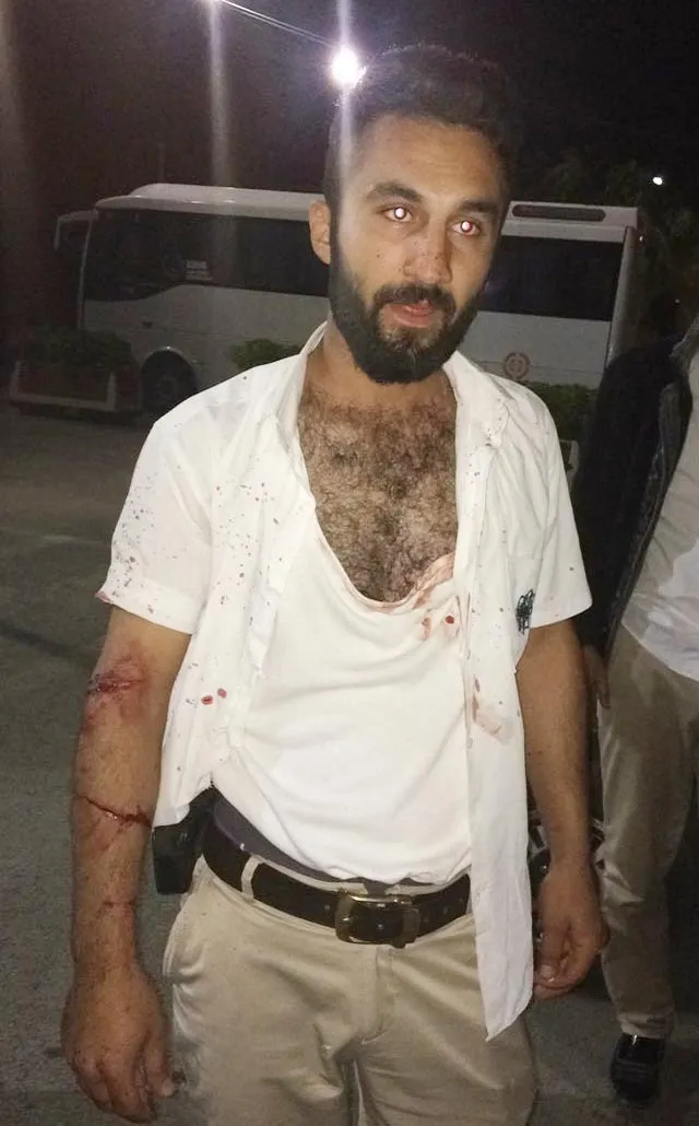 Konya'da otobüs şoförüne bıçaklı saldırı - 2