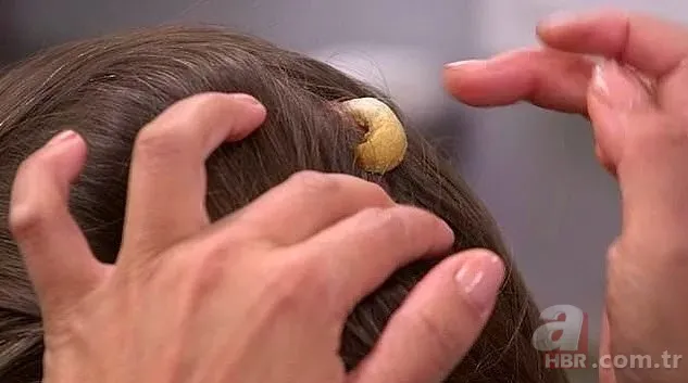 Bilim insanları şaşkın! Kafasında boynuz çıktı... 2