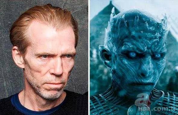 Ünlü oyuncuyu görenler gözlerine inanamadı! Tanınmaz hale geldi 10