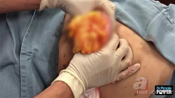 30 yıl boyunca baş ağrısıyla yaşadı! Nedeni şoke etti... 128