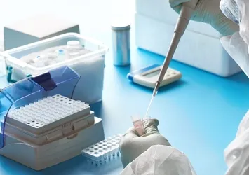 Son dakika: Koronavirüse yakalanan kişilerin ölüp ölmeyeceğini bilen test geliştirildi! Dünyayı şaşırtan flaş gelişme!
