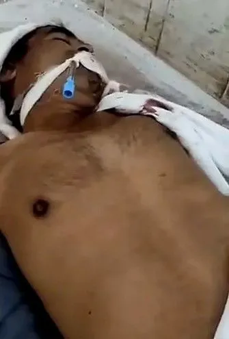 Öldü sanıp morga indirdiler! Gerçek 6 saat sonra ortaya çıktı - 2